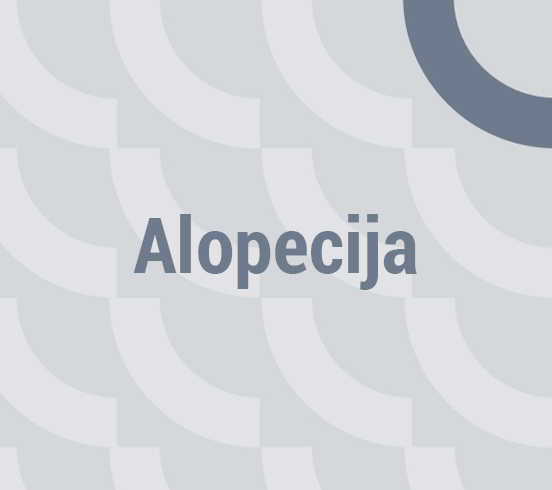 Alopecija